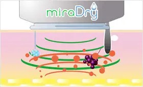 ミラドライの仕組み｜マイクロ波のエネルギーは水分子に吸収されて熱に変わる